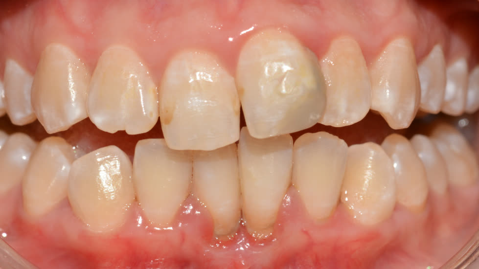 Case 1: before