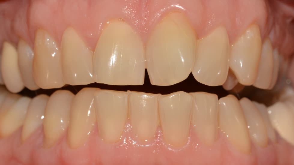 Case 2: before