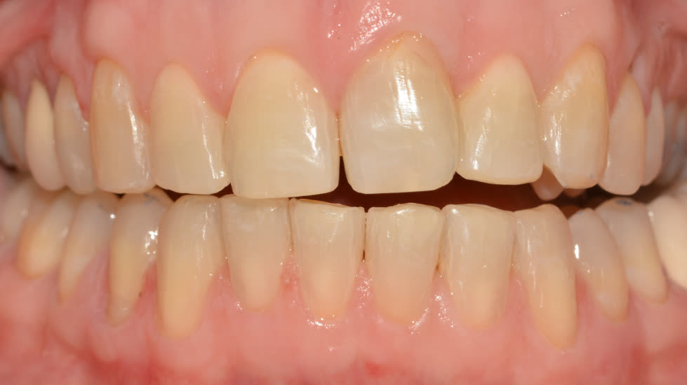 Case 2: after