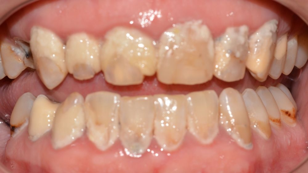 Case 4: before