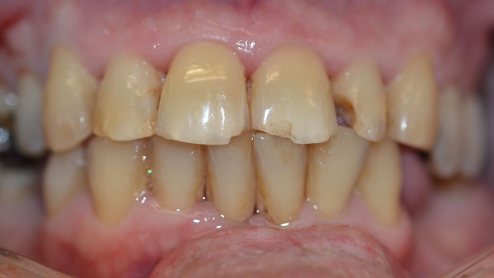 Case 5: before