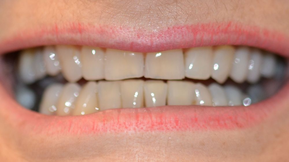 Case 6: before