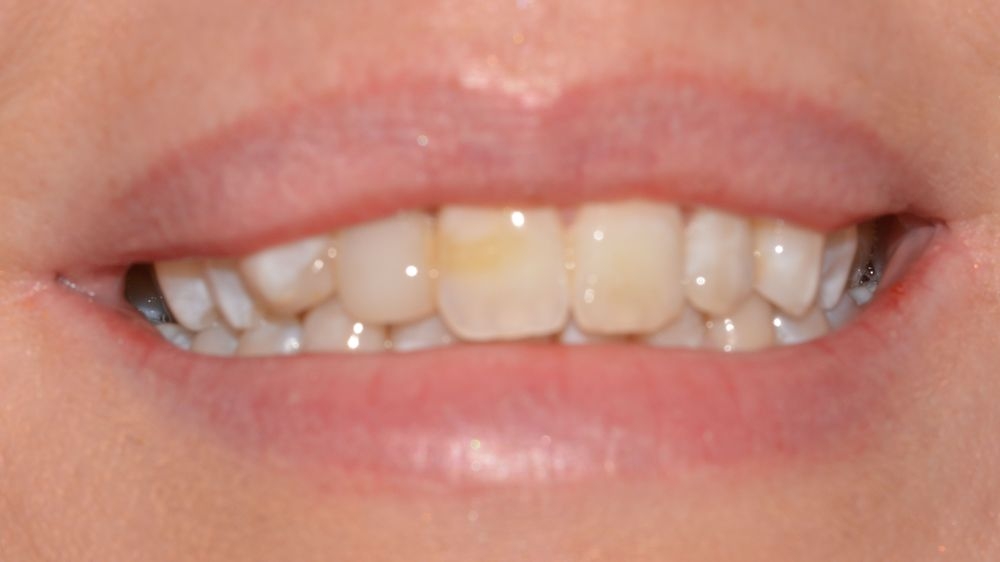Case 7: before