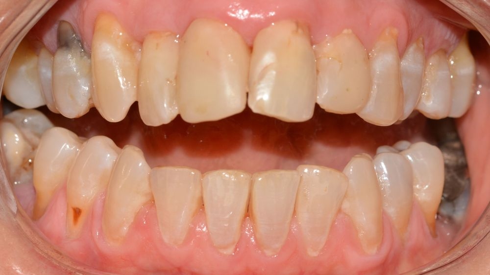 Case 8: before