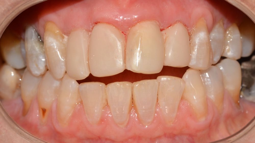 Case 8: after
