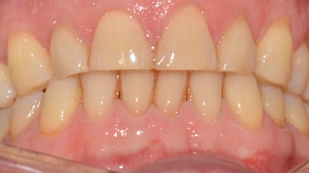 Case 9: before