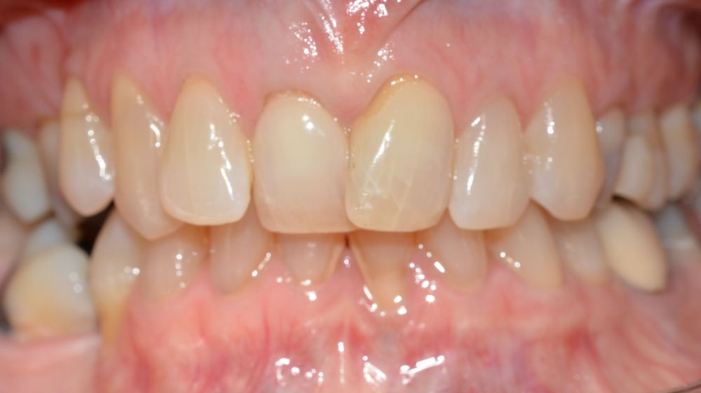 Case 10: before