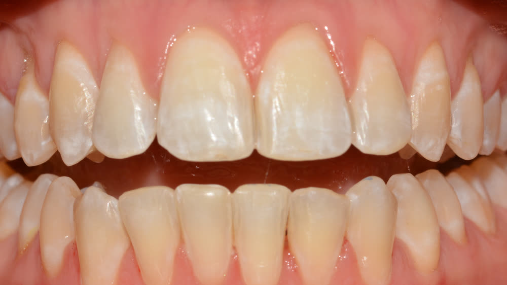 Case 12: after