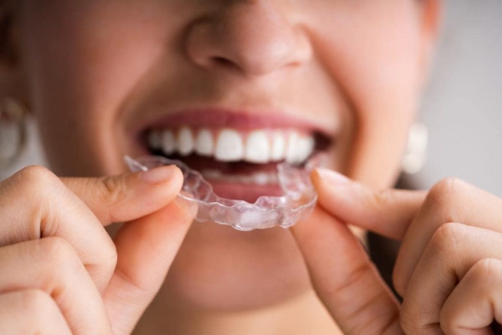 Night Guards & Sports Mouth Guards