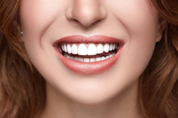 Teeth Whitening